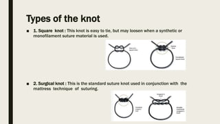 Types of the knot
■ 1. Square knot : This knot is easy to tie, but may loosen when a synthetic or
monofilament suture material is used.
■ 2. Surgical knot : This is the standard suture knot used in conjunction with the
mattress technique of suturing.
 