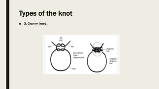 Types of the knot
■ 3. Granny knot :
 
