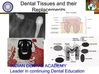 Dental Tissues and their
Replacements
INDIAN DENTAL ACADEMY
Leader in continuing Dental Education
 