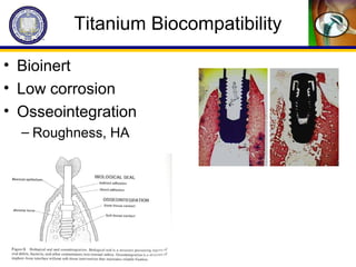 Titanium Biocompatibility
• Bioinert
• Low corrosion
• Osseointegration
– Roughness, HA
 