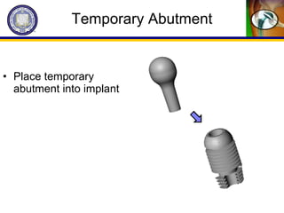 • Place temporary
abutment into implant
Temporary Abutment
 