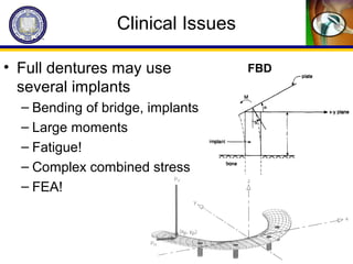 Clinical Issues
• Full dentures may use
several implants
– Bending of bridge, implants
– Large moments
– Fatigue!
– Complex combined stress
– FEA!
FBD
 