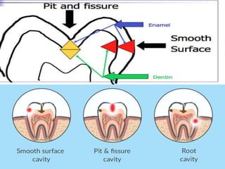 Dental tooth nomenclature | PPTX