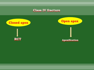 Closed apex
Open apex
RCT Apexification
Class IV fracture
 