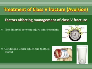 Treatment of Class V fracture (Avulsion)
Factors affecting management of class V fracture
 Time interval between injury and treatment
 Conditions under which the tooth is
stored
 