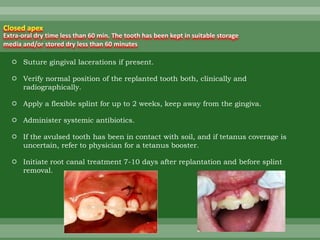  Suture gingival lacerations if present.
 Verify normal position of the replanted tooth both, clinically and
radiographically.
 Apply a flexible splint for up to 2 weeks, keep away from the gingiva.
 Administer systemic antibiotics.
 If the avulsed tooth has been in contact with soil, and if tetanus coverage is
uncertain, refer to physician for a tetanus booster.
 Initiate root canal treatment 7-10 days after replantation and before splint
removal.
Closed apex
Extra-oral dry time less than 60 min. The tooth has been kept in suitable storage
media and/or stored dry less than 60 minutes
 