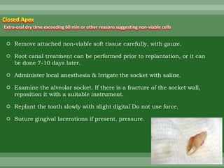  Remove attached non-viable soft tissue carefully, with gauze.
 Root canal treatment can be performed prior to replantation, or it can
be done 7-10 days later.
 Administer local anesthesia & Irrigate the socket with saline.
 Examine the alveolar socket. If there is a fracture of the socket wall,
reposition it with a suitable instrument.
 Replant the tooth slowly with slight digital Do not use force.
 Suture gingival lacerations if present. pressure.
Closed Apex
Extra-oral dry time exceeding 60 min or other reasons suggesting non-viable cells
 