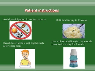 Patient instructions
Avoid participation in contact sports Soft food for up to 2 weeks
Brush teeth with a soft toothbrush
after each meal
Use a chlorhexidine (0.1 %) mouth
rinse twice a day for 1 week.
 