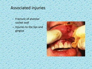 Dental Trauma.ppt