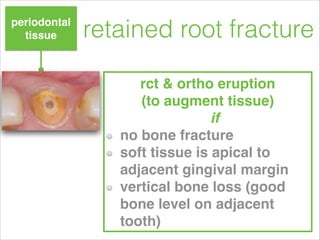 splinting- semirigid splint
resin with waxed dental ﬂoss, suture,
ﬂexible braided ortho wire or
monoﬁlament nylon line!
ke...
