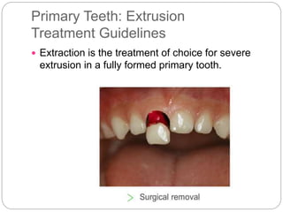 Primary Teeth: Extrusion
Treatment Guidelines
 Extraction is the treatment of choice for severe
extrusion in a fully formed primary tooth.
 