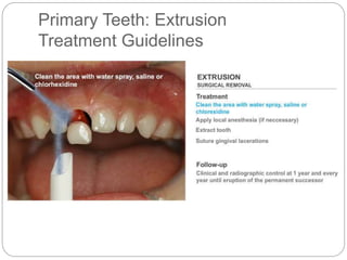 Primary Teeth: Extrusion
Treatment Guidelines
 