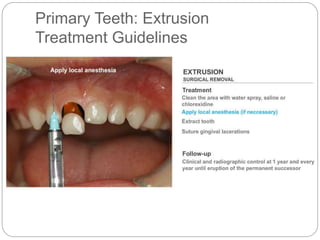 Primary Teeth: Extrusion
Treatment Guidelines
 