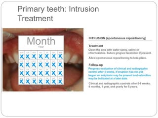 Primary teeth: Intrusion
Treatment
 