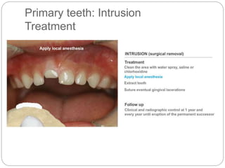 Primary teeth: Intrusion
Treatment
 