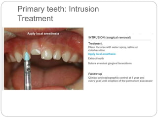 Primary teeth: Intrusion
Treatment
 