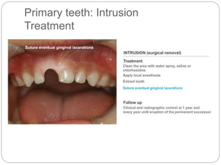 Primary teeth: Intrusion
Treatment
 