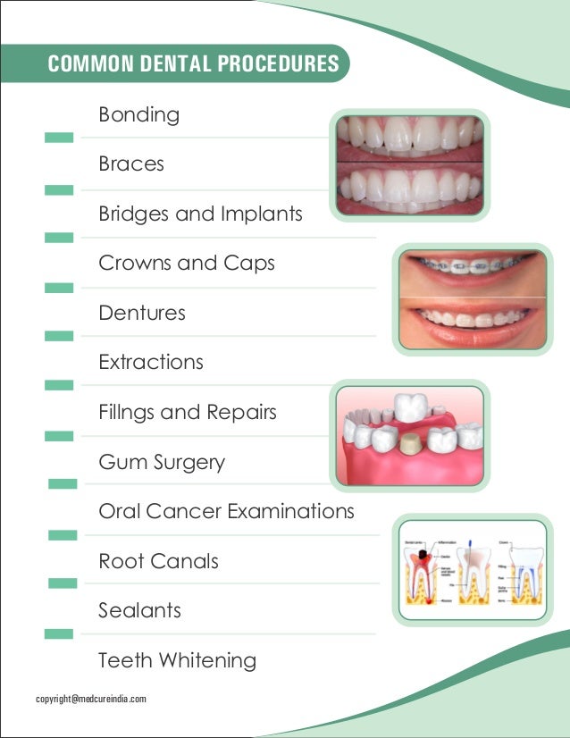 Dental Procedures and Treatments Dentistry