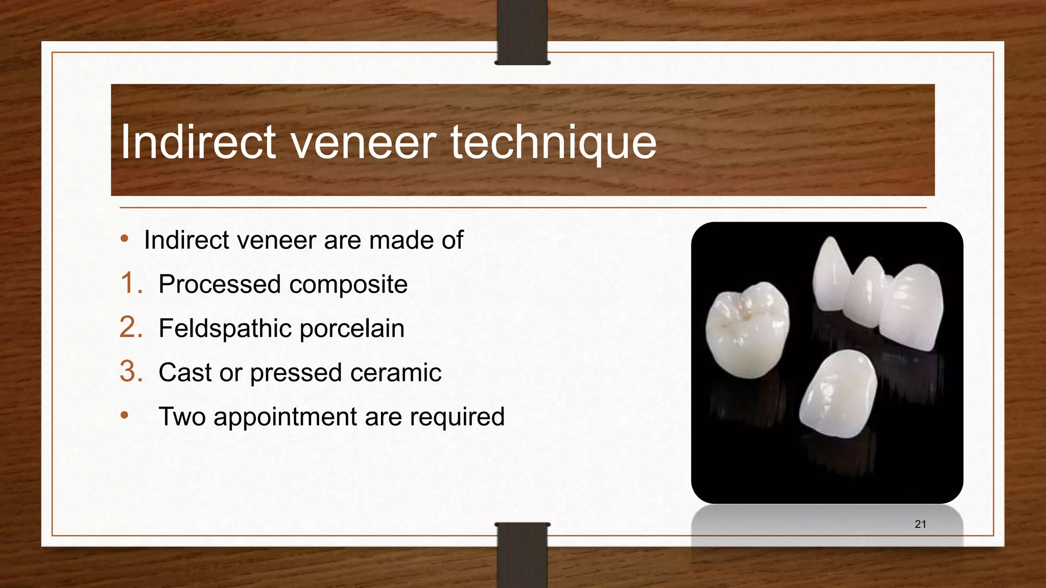 Dental veneer @ | PPTX