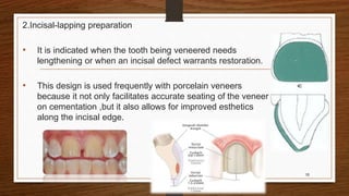2.Incisal-lapping preparation
• It is indicated when the tooth being veneered needs
lengthening or when an incisal defect warrants restoration.
• This design is used frequently with porcelain veneers
because it not only facilitates accurate seating of the veneer
on cementation ,but it also allows for improved esthetics
along the incisal edge.
10
 