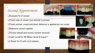 24
Second Appointment
Evaluate fit of veneer.
Tooth side of veneer (pre etched) is primed.
Tooth etched, rinsed and dried. Adhesive is applied but not cured.
Adhesive cement applied.
Veneer placed and excess cement removed.
Light cured for 40-60sec facial & lingual.*
 Check for fit with no.2 explorer.
 
