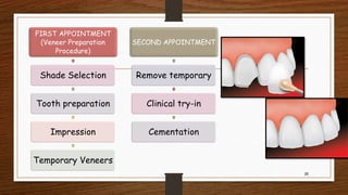 26
FIRST APPOINTMENT
(Veneer Preparation
Procedure)
Shade Selection
Tooth preparation
Impression
Temporary Veneers
SECOND APPOINTMENT
Remove temporary
Clinical try-in
Cementation
 