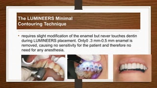 The LUMINEERS Minimal
Contouring Technique
• requires slight modification of the enamel but never touches dentin
during LUMINEERS placement. Only0 .3 mm-0.5 mm enamel is
removed, causing no sensitivity for the patient and therefore no
need for any anesthesia.
35
 
