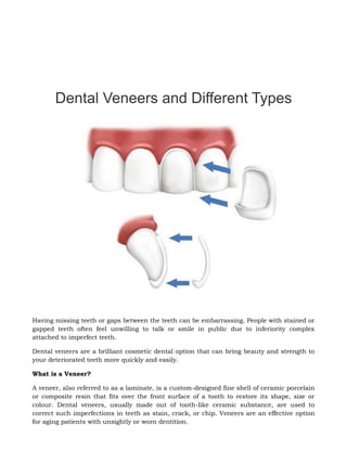 Dental Veneers and Different Types
Having missing teeth or gaps between the teeth can be embarrassing. People with stained or
gapped teeth often feel unwilling to talk or smile in public due to inferiority complex
attached to imperfect teeth.
Dental veneers are a brilliant cosmetic dental option that can bring beauty and strength to
your deteriorated teeth more quickly and easily.
What is a Veneer?
A veneer, also referred to as a laminate, is a custom-designed fine shell of ceramic porcelain
or composite resin that fits over the front surface of a tooth to restore its shape, size or
colour. Dental veneers, usually made out of tooth-like ceramic substance, are used to
correct such imperfections in teeth as stain, crack, or chip. Veneers are an effective option
for aging patients with unsightly or worn dentition.
 