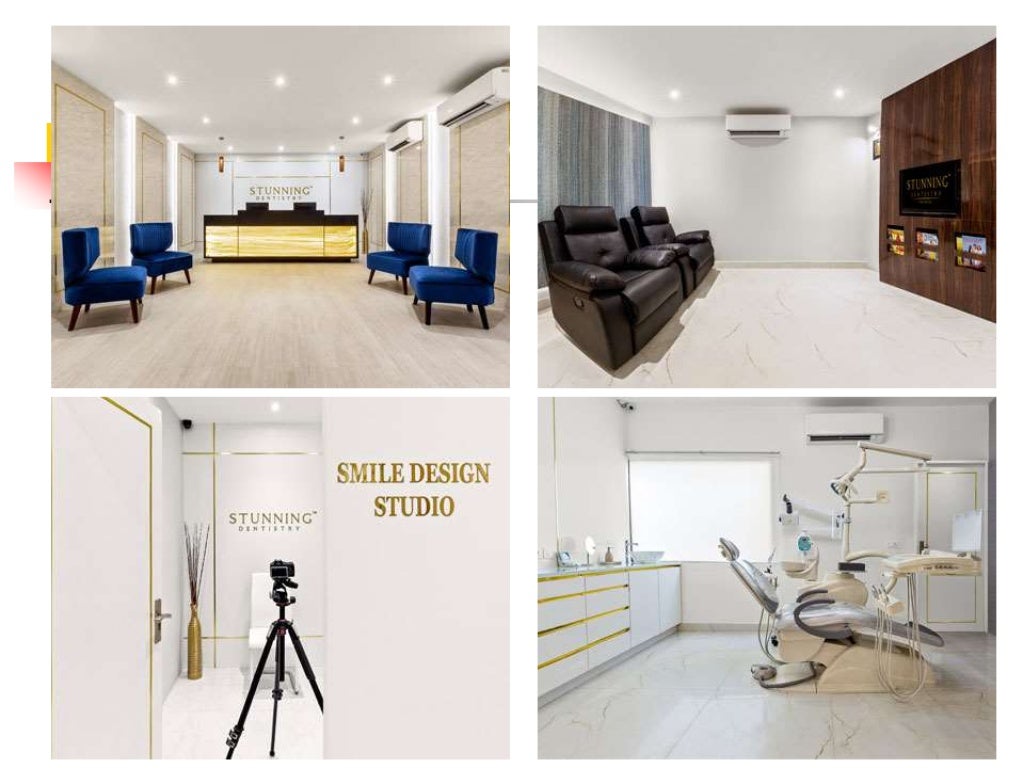 Dental Veneers in India