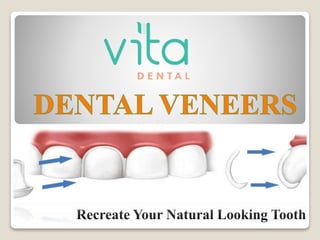 Recreate Your Natural Looking Tooth
 