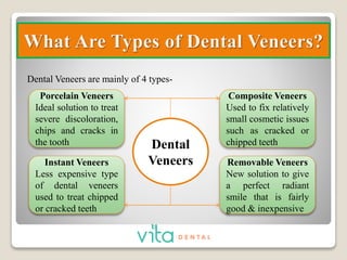 Dental Veneers Treatment- Complete Guide PPTX