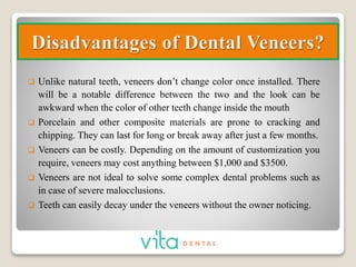 Dental Veneers Treatment- Complete Guide PPTX