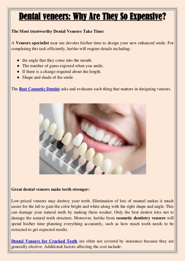 Dental veneers why are they so expensive
