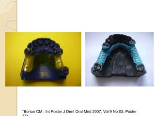 *Bortun CM ; Int Poster J Dent Oral Med 2007, Vol 9 No 03, Poster
 