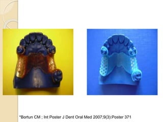 *Bortun CM ; Int Poster J Dent Oral Med 2007;9(3):Poster 371
 
