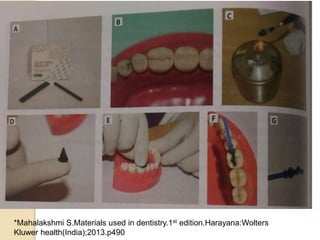 *Mahalakshmi S.Materials used in dentistry.1st edition.Harayana:Wolters
Kluwer health(India);2013.p490
 
