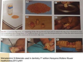 Mahalakshmi S.Materials used in dentistry.1st edition.Harayana:Wolters Kluwer
health(India);2013.p491
 