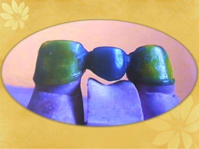 Dental waxes\dental materials ppt