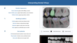Dental X-Rays_ Fundamentals and Advanced Technologies.pptxhhhjjj | PPTX