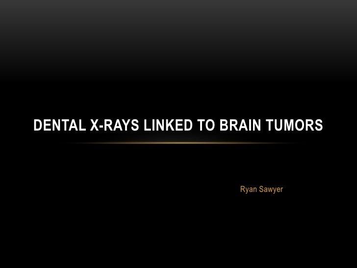 Dental x rays linked to brain tumors