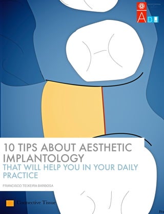 10 TIPS ABOUT AESTHETIC
IMPLANTOLOGY
THAT WILL HELP YOU IN YOUR DAILY
PRACTICE
FRANCISCO TEIXEIRA BARBOSA
 