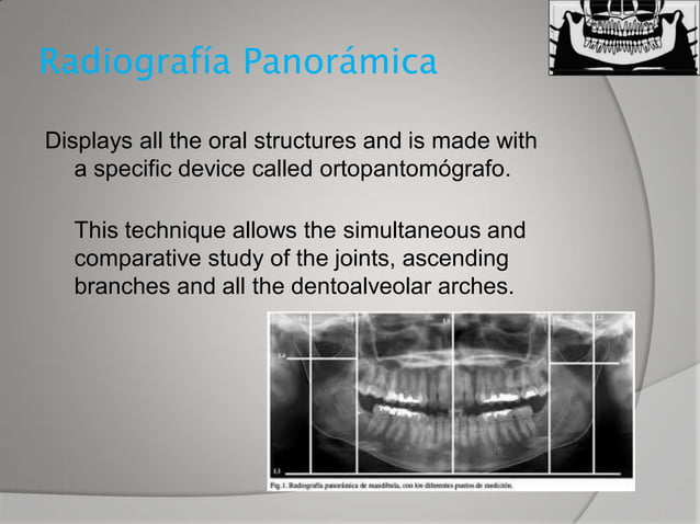 Dental x ray | PDF