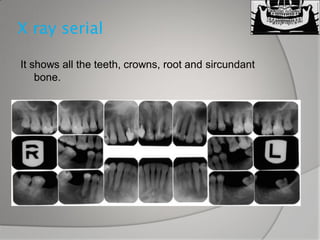 Dental x ray | PDF