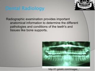 Dental x ray | PPT