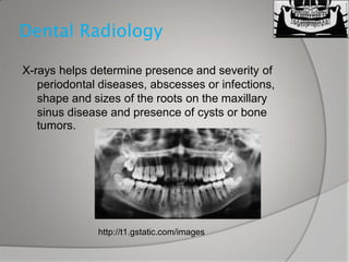 Dental x ray | PPT
