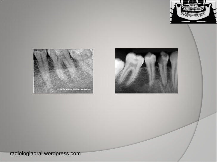 Dental x ray