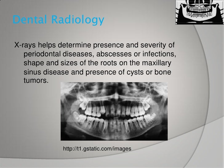 Dental x ray
