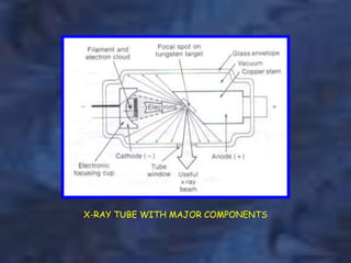 X-RAY TUBE WITH MAJOR COMPONENTS
 