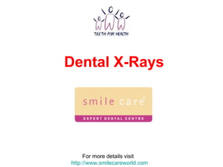 Dental X-Rays  For more details visit  http://www.smilecareworld.com 