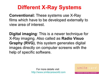 For more details visit  http://www.smilecareworld.com Different X-Ray Systems Conventional:  These systems use X-Ray films which have to be developed externally to view area of interest.  Digital imaging : This is a newer technique for  X-Ray imaging. Also called as  Radio Visuo Graphy (RVG) , this system generates digital images directly on computer screens with the help of specific software.  